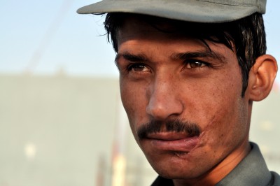 Afghan National Policeman showing injuries incurred in a Taliban ambush